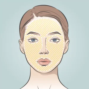 HIFU full face treatment