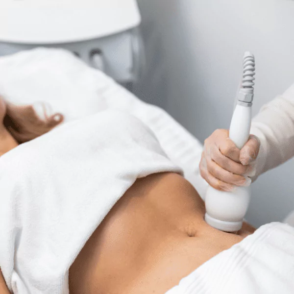 Fat Cavitation fat loss treatment on tummy