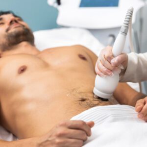 Belly Fat Removal without surgery on male via fat cavitation