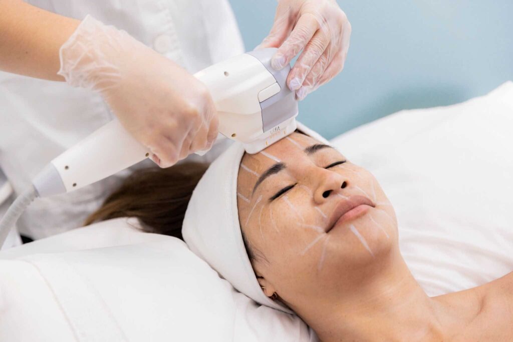 NOTOX Treatment to woman's face