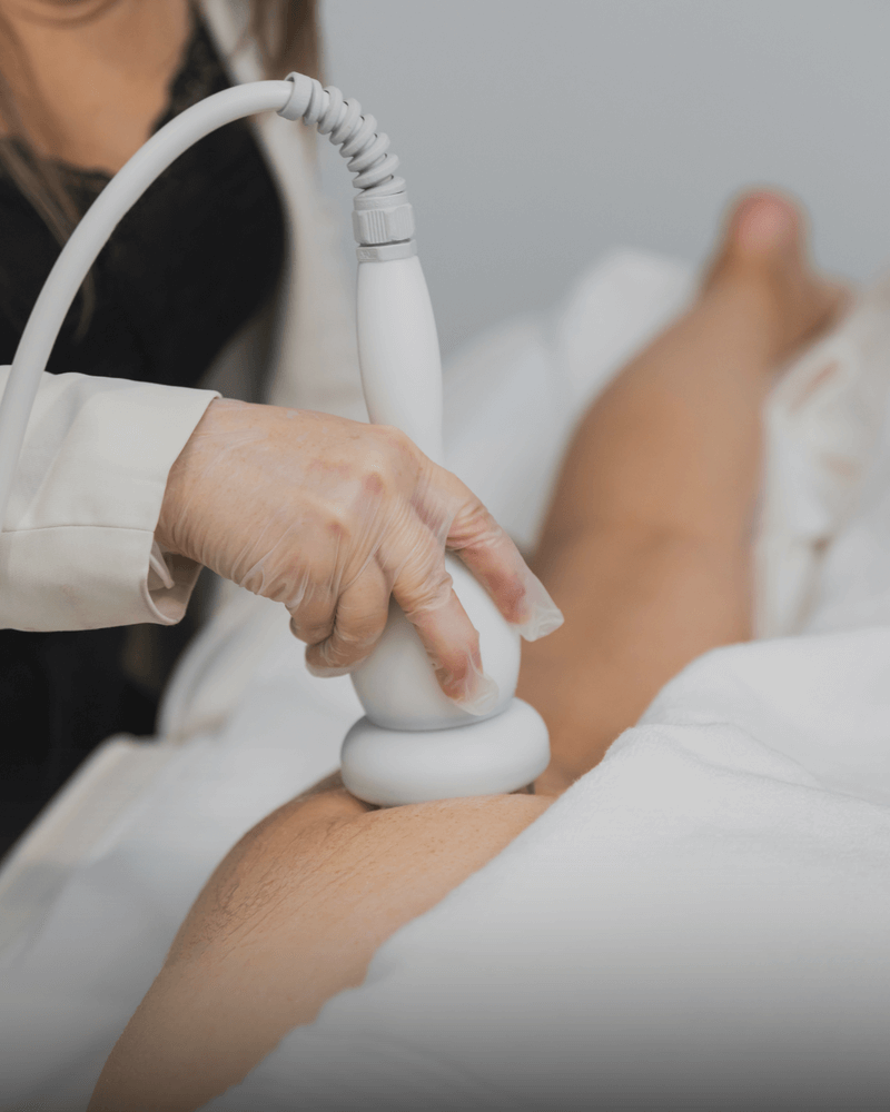 cellulite reduction treatment body catalyst