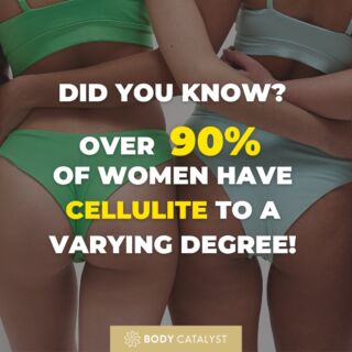 Did you know, over 90% of women experience cellulite to a varying degree? That is over 3 billion women in the world!‼️⁠
⁠
Not only is cellulite completely normal, but it can pesker as a concern, which is why we’ve created the ultimate cellulite buster to help bring you the confidence that you deserve. 😌🤍⁠
⁠
Cellulite appears due to stubborn fat cells which permeate through weakened skin tissue. As this can be a result from lifestyle, diet or work, majority of the time it is a result of genetics and therefore need a booster to help shift the stubbornness.⁠
⁠
At Body Catalyst, we are here to act as your booster taking a holistic approach to cellulite reduction. We combine Fat Cavitation to break down stubborn fat cells, with Radio Frequency skin tightening to firm and tighten weakened skin tissues, and finish it off with the TeslaFormer Muscle Definer, which strengthens the underlying muscles whilst accelerating your lymphatic system, to achieve maximal, accelerated results! 🤩⁠
⁠
Ready to learn more? Click the link in bio today.⁠
⁠
#cellulite #cellulitereduction #cellulitetreatment #removecellulite #skintightening #muscledefining #radiofrequency #fatcavitation #teslaformer #bodycatalyst