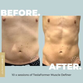 Lookin’ BODY good! 🤩⁠
⁠
We live for these ab-solutely amazing results! 😉⁠
⁠
In just 30 minutes, Functional Magnetic Stimulation activates 100% of the muscle group sending up to 50,000 pulses — or the equivalent of 50,000 crunches! 😱⁠
⁠
Wish these abs of steel were yours? Book a date with the TeslaFormer Muscle Definer and start sculpting your physique NOW!⁠
⁠
Want to know the best part? The TeslaFormer is ON SALE NOW for just $139/session (*pre-pay 5 or 10 sessions)! 🤑⁠
⁠
Click the link in bio to feel body firm and fabulous with the TeslaFormer Muscle Definer!⁠
⁠
#bodycatalyst #mybodycatalyst #teslaformer #teslaformermuscledefiner #muscledefiner #muscledefinition #FMS #FMStechnology #emsculpt #muscles #muscletoning #bodytransformation #weightloss #fatloss #bodygoals #bodypositive #bodysculpting #gym #gymjunkie #workout ⁠